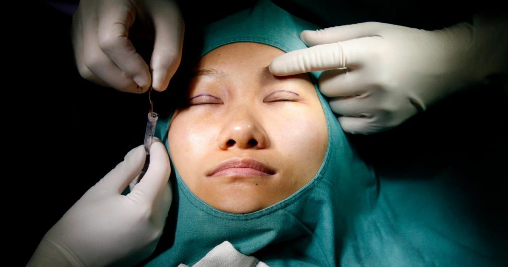 Cosmetic procedures are becoming the new norm in China