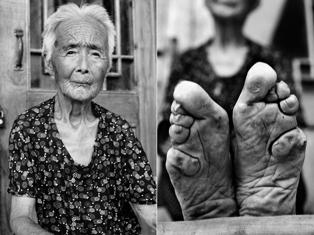 Outlawed Foot-Binding Practice in China