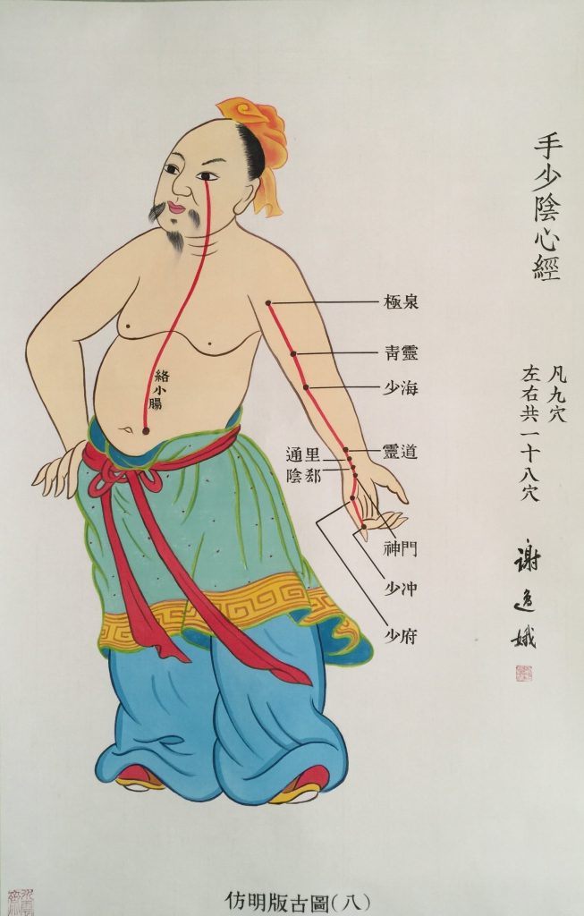 Acupuncture is still practiced today.